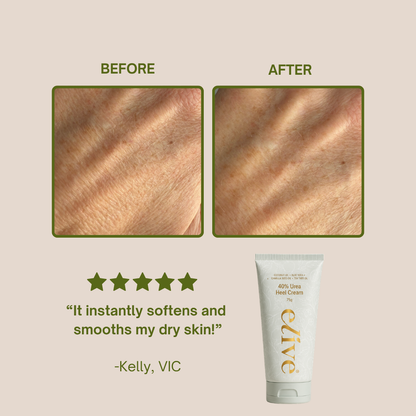 40% Urea Heel Cream 75g
